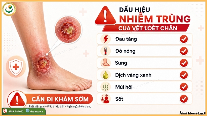 dấu hiệu nhiễm trùng vết loét chân