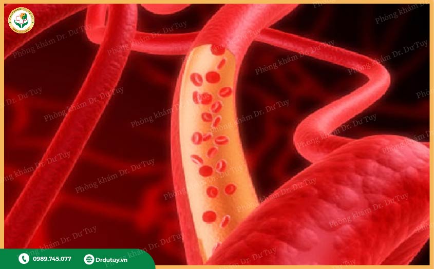 đèn hồng ngoại điều trị vết loét