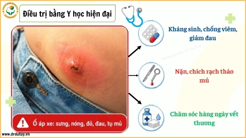điều trị áp xe theo y học hiện đại