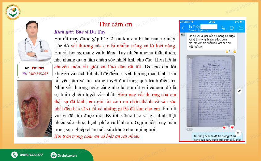 điều trị bỏng
