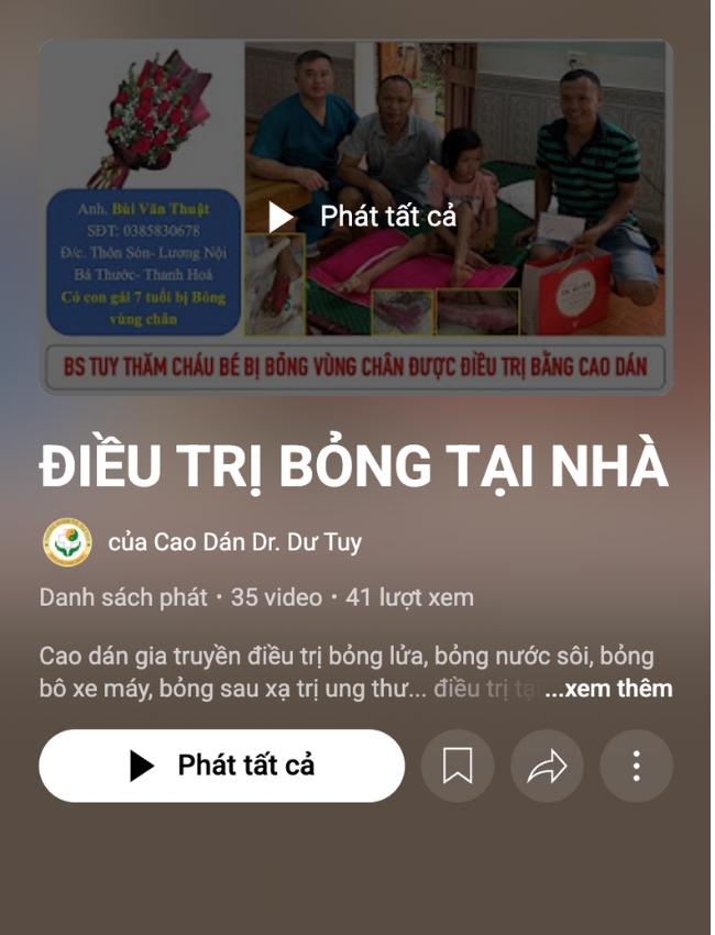 điều trị bỏng tại nhà