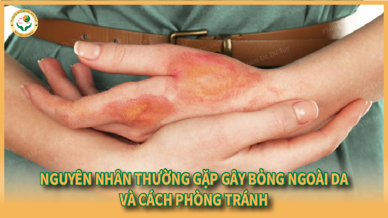 Nguyên nhân thường gặp gây bỏng ngoài da và cách phòng tránh