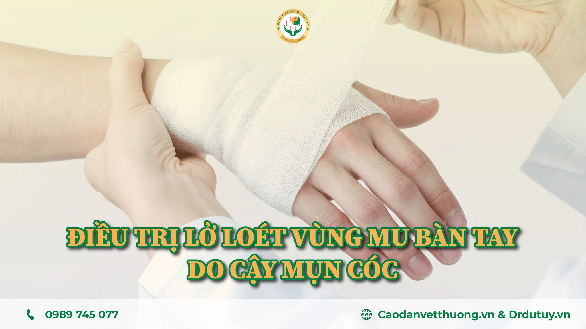 Điều trị vết loét mu bàn tay do cậy mụn cóc