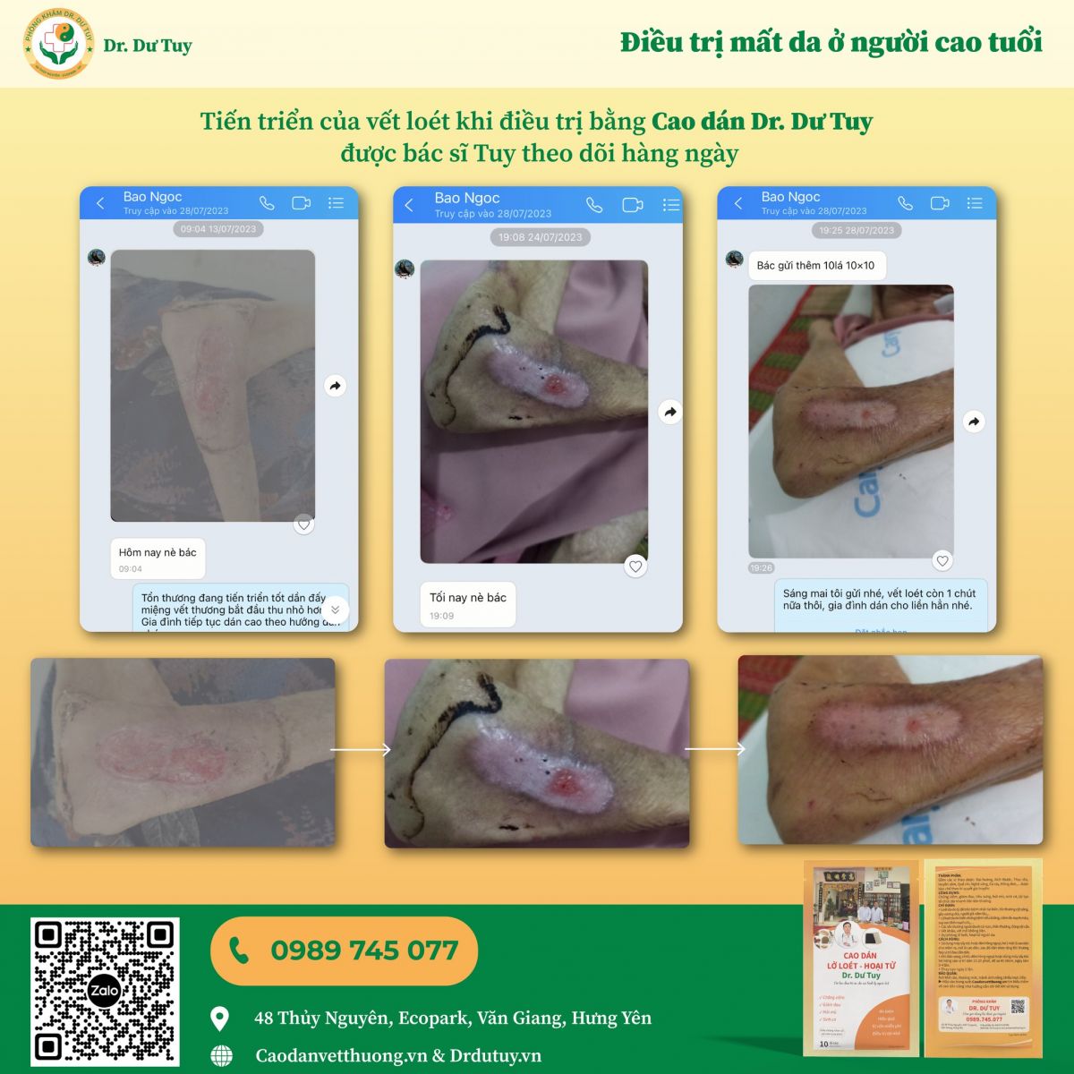 dieu-tri-lo-loet-da-o-nguoi-cao-tuoi-nhu-the-nao