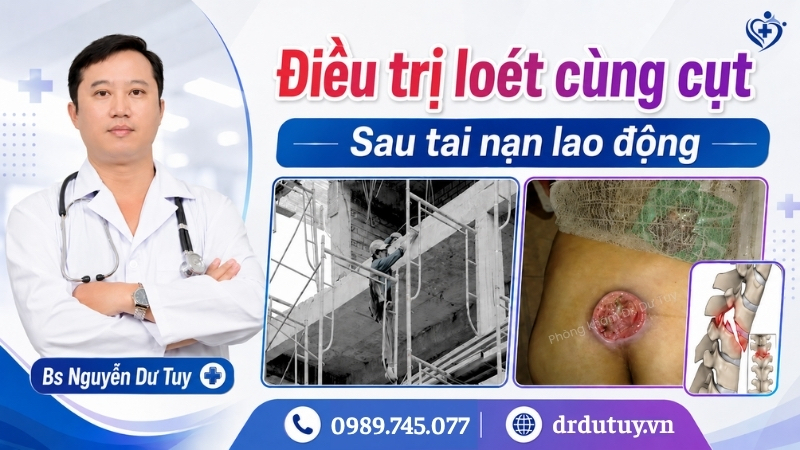 Điều trị loét cùng cụt sau tai nạn lao động: Quá trình phục hồi qua hình ảnh thực tế