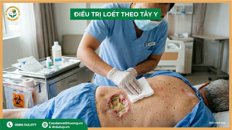 điều trị loét tỳ đè theo tây y