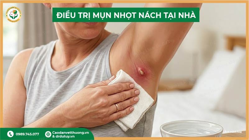 điều trị mụn nhọt nách tại nhà