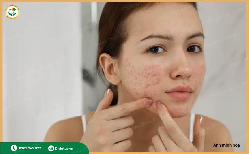 điều trị mụn nhọt