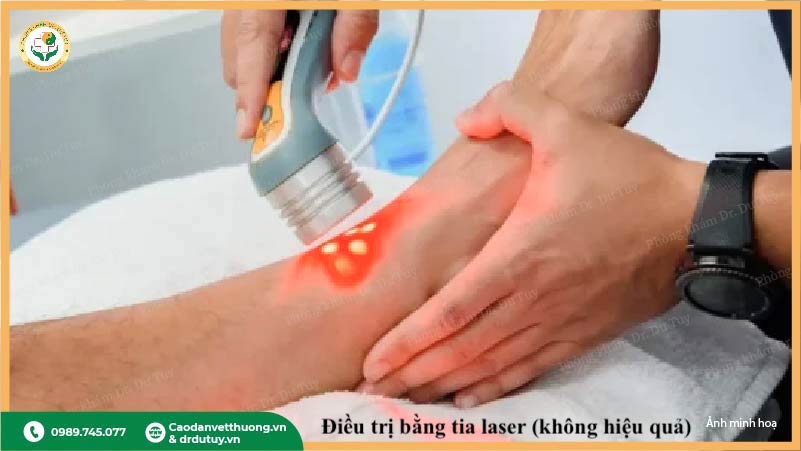 điều trị vết thương bằng tia laser không hiệu quả