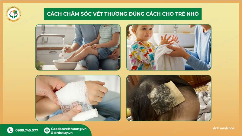 điều trị vết thương cho bé