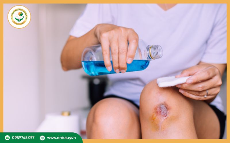 Xử lý vết thương hở đúng cách 