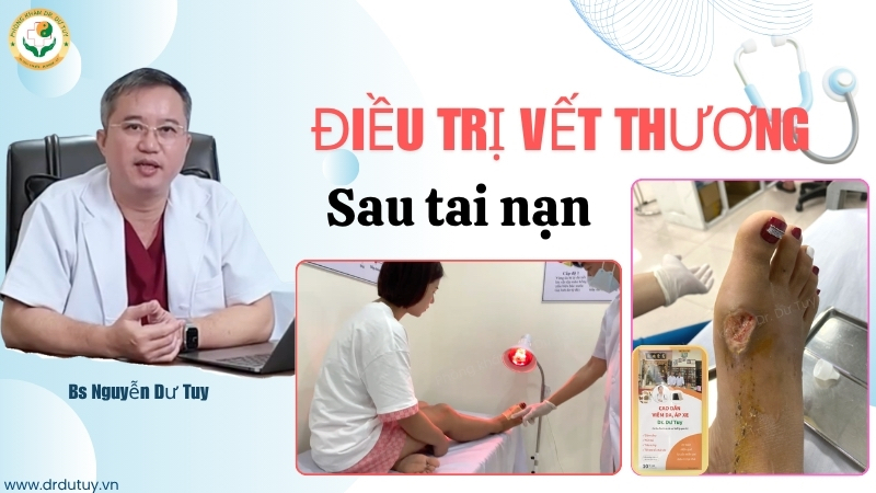 Điều trị vết thương sau tai nạn xe máy: Đừng chủ quan với những tổn thương ngoài da
