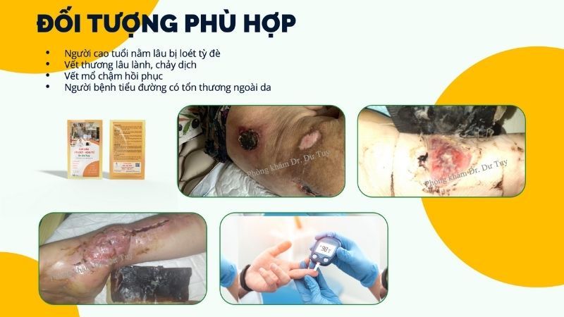 đối tượng phù hợp loét tỳ đè tiểu đường vết thương lâu lành