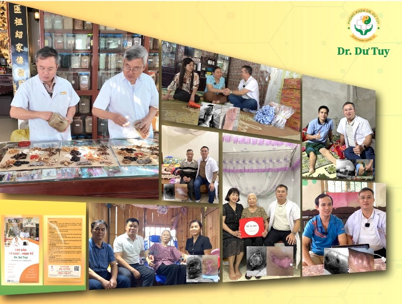 Dr. Dư Tuy điều trị vết loét hoại tử thăm khám tại nhà