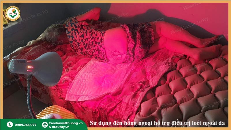 dùng đèn hồng ngoại hỗ trợ điều trị vết loét