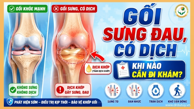 gối sưng đau có dịch khi nào cần đi khám