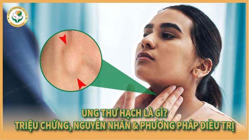 Ung thư hạch là gì? Triệu chứng, nguyên nhân & phương pháp điều trị 