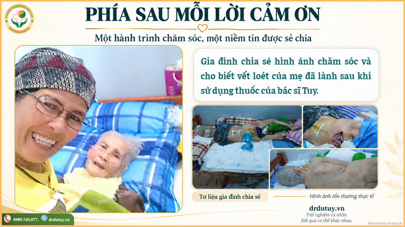 hình ảnh chăm sóc vết loét Dr. Dư Tuy