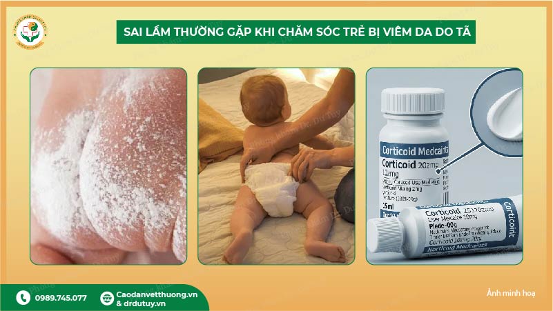hình ảnh viêm da dị ứng ở trẻ so sinh