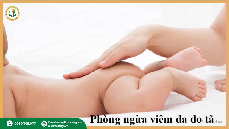 hình ảnh viêm da ở trẻ sơ sinh