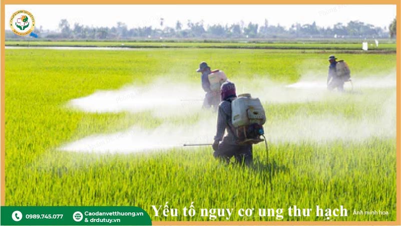 hoá chất độc hại nguy cơ ung thư hạch