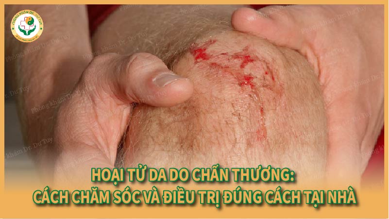Hoại tử da do chấn thương: Cách chăm sóc và điều trị đúng cách tại nhà