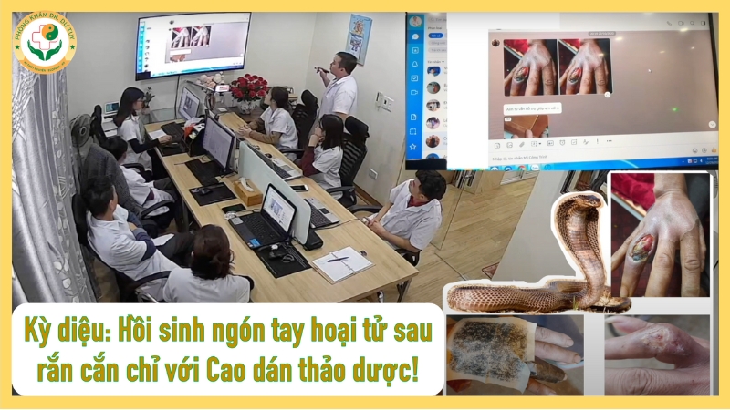 Kỳ diệu: Hồi sinh ngón tay hoại tử sau rắn cắn chỉ với Cao dán thảo dược!