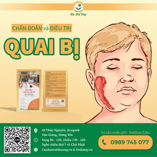 Hướng dẫn chẩn đoán và điều trị quai bị