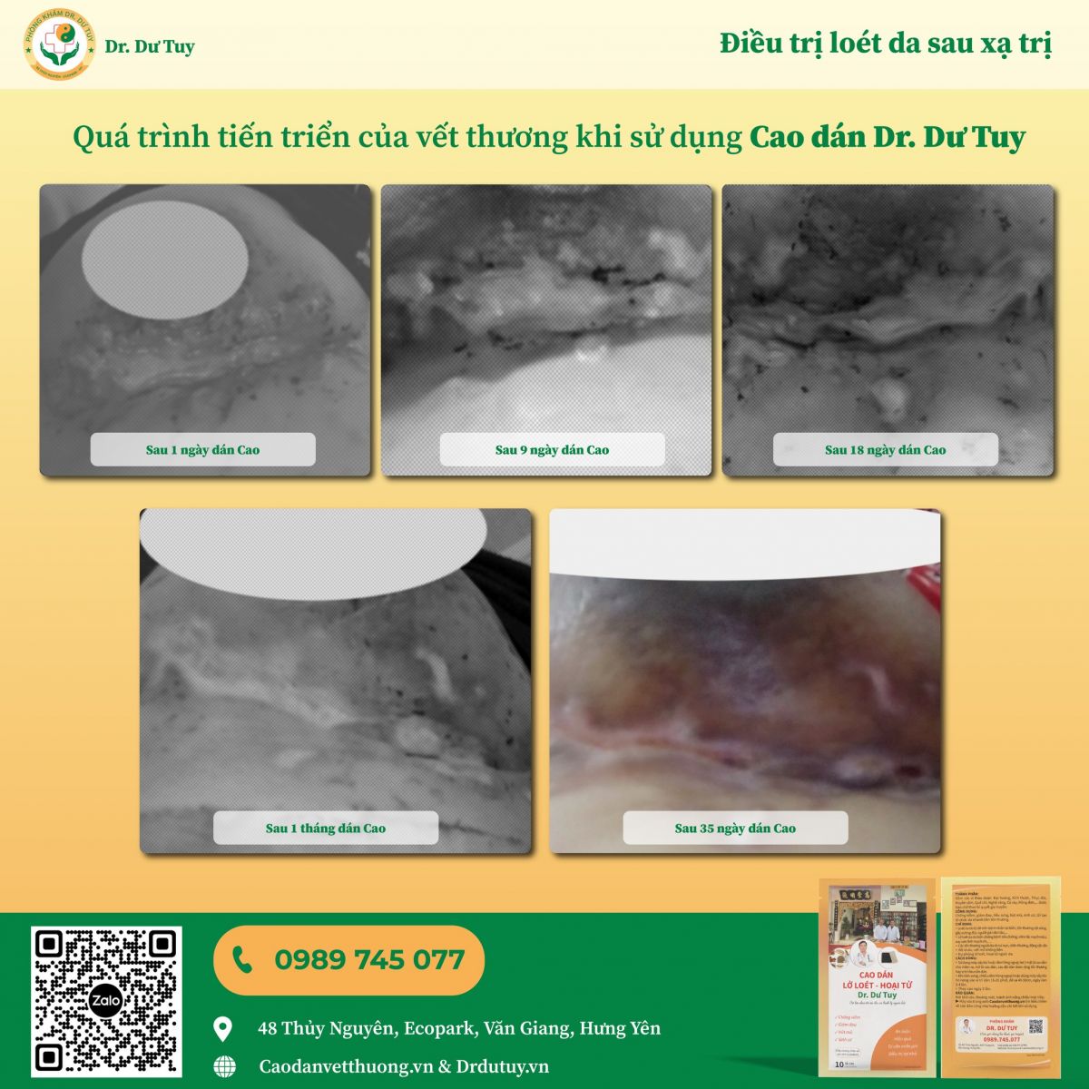 Diễn biến bệnh lý