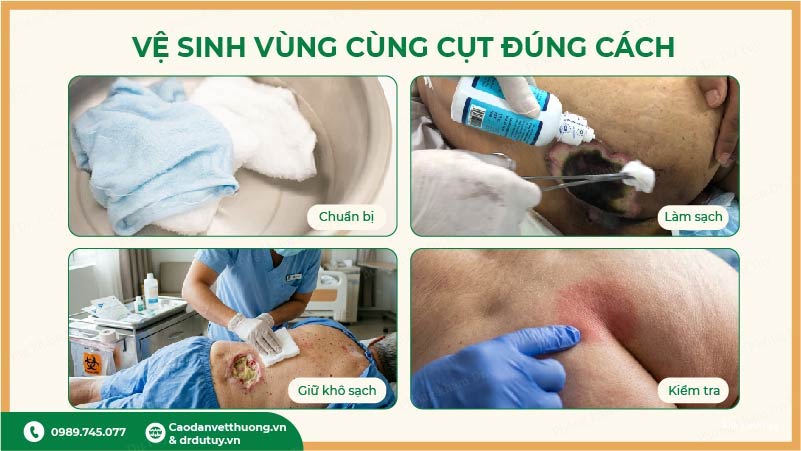 hướng dẫn vệ sinh vùng cùng cụt đúng cách