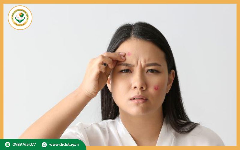 Lý do nên hút mủ mụn nhọt