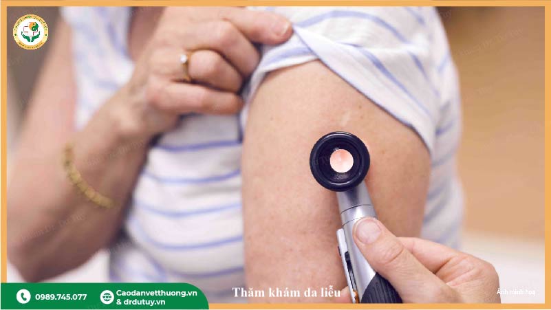 khám và điều trị áp xe sau tiêm