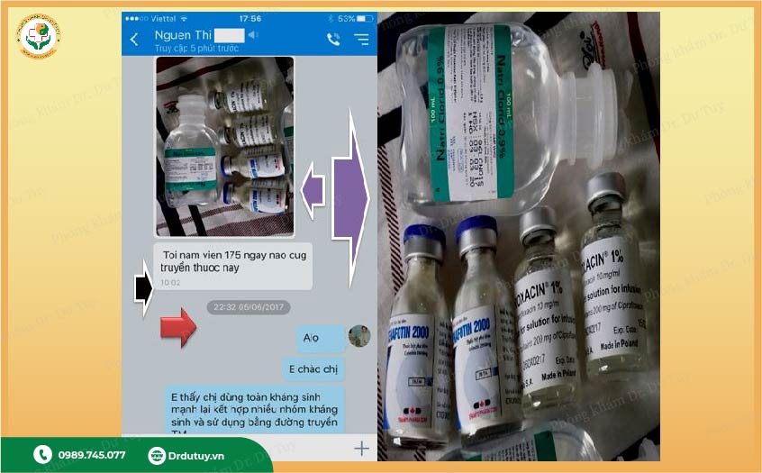 kháng sinh trị sưng đau khớp gối