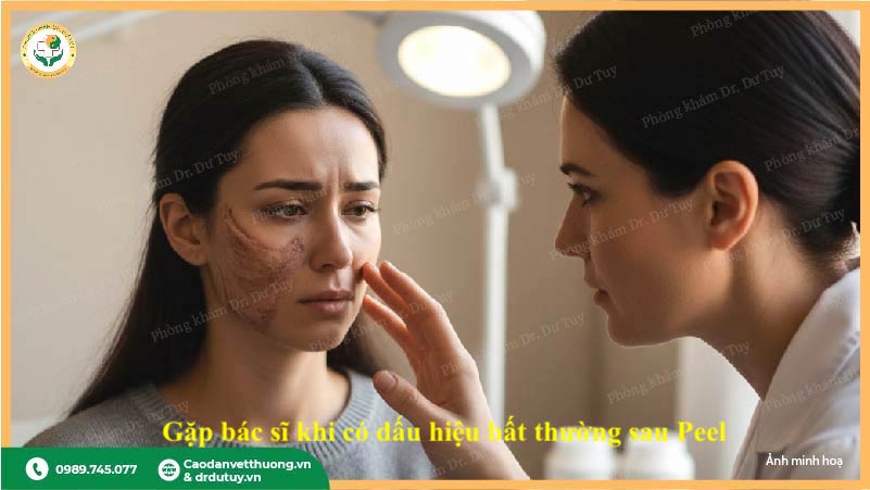 khi nảo cần gặp bác sĩ bỏng da sau peel