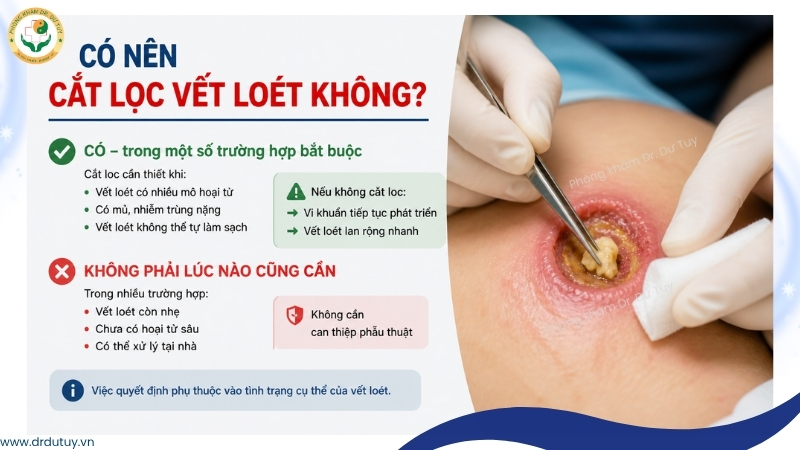 khi nào nên cắt lọc vết loét