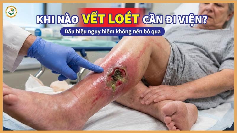 khi nào vết loét cần đi viện