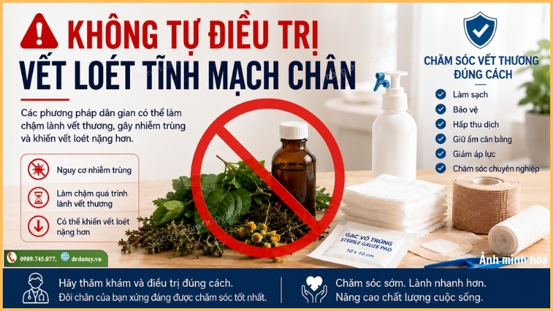 không tự điều trị vết loét tĩnh mạch chân