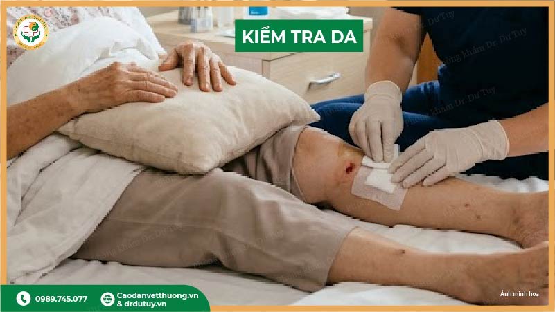 kiểm tra da phát hiện loét