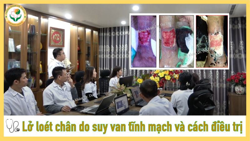 lở loét chân do suy van tĩnh mạch