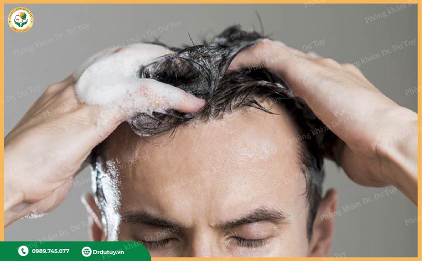 Các triệu chứng nguy hiểm cần lưu ý khi bị lở loét da đầu