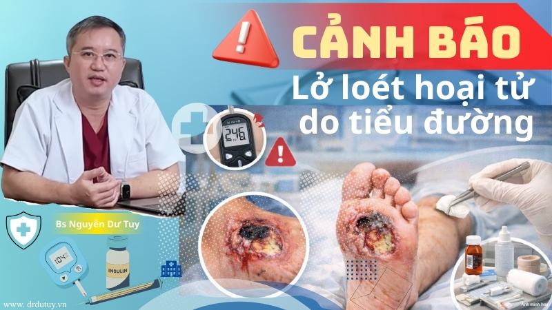 Lở loét hoại tử ngoài da do biến chứng tiểu đường: Dấu hiệu cảnh báo và cách điều trị hiệu quả