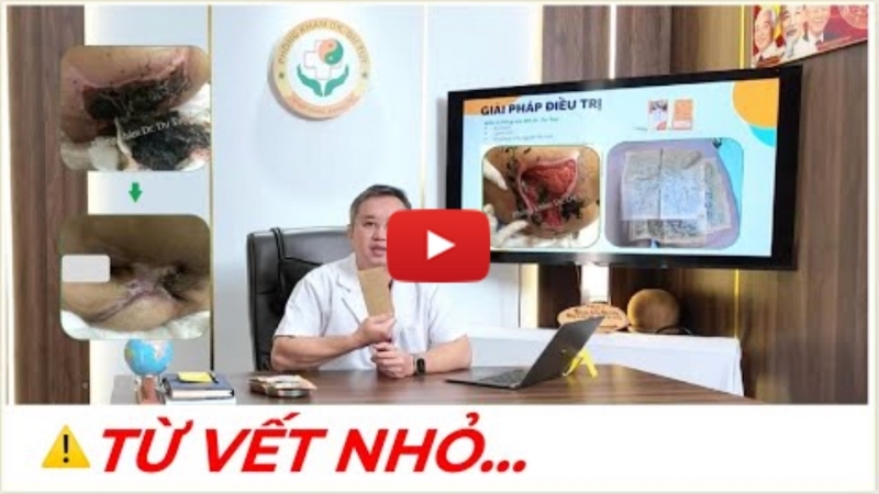 lở loét da vùng cùng cụt