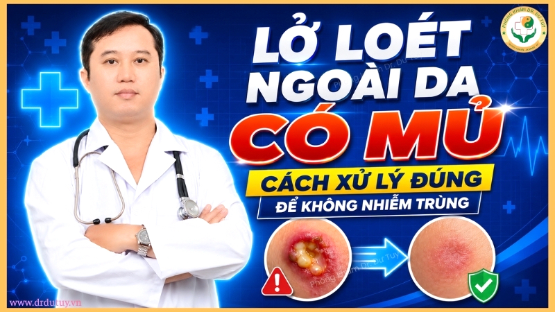 lở loét ngoài da có mủ cách xử lý đúng