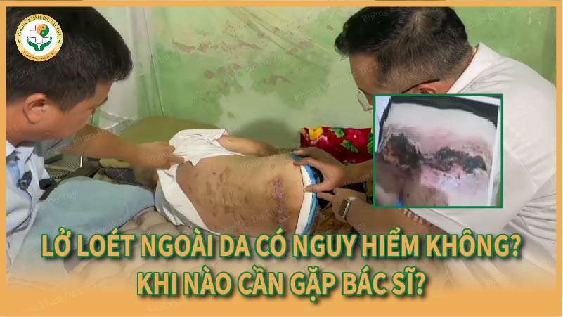 Lở loét ngoài da có nguy hiểm không? Khi nào cần gặp bác sĩ?