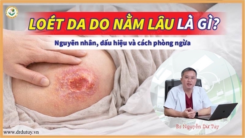 Loét da do nằm lâu là gì? Nguyên nhân, dấu hiệu và cách phòng ngừa