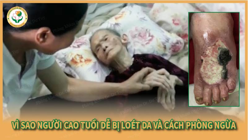 Vì sao người cao tuổi dễ bị loét da và cách phòng ngừa