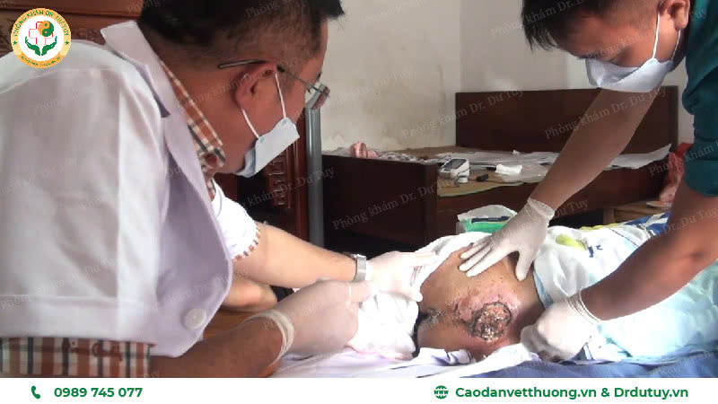 loét da ở người suy giảm sức đề kháng