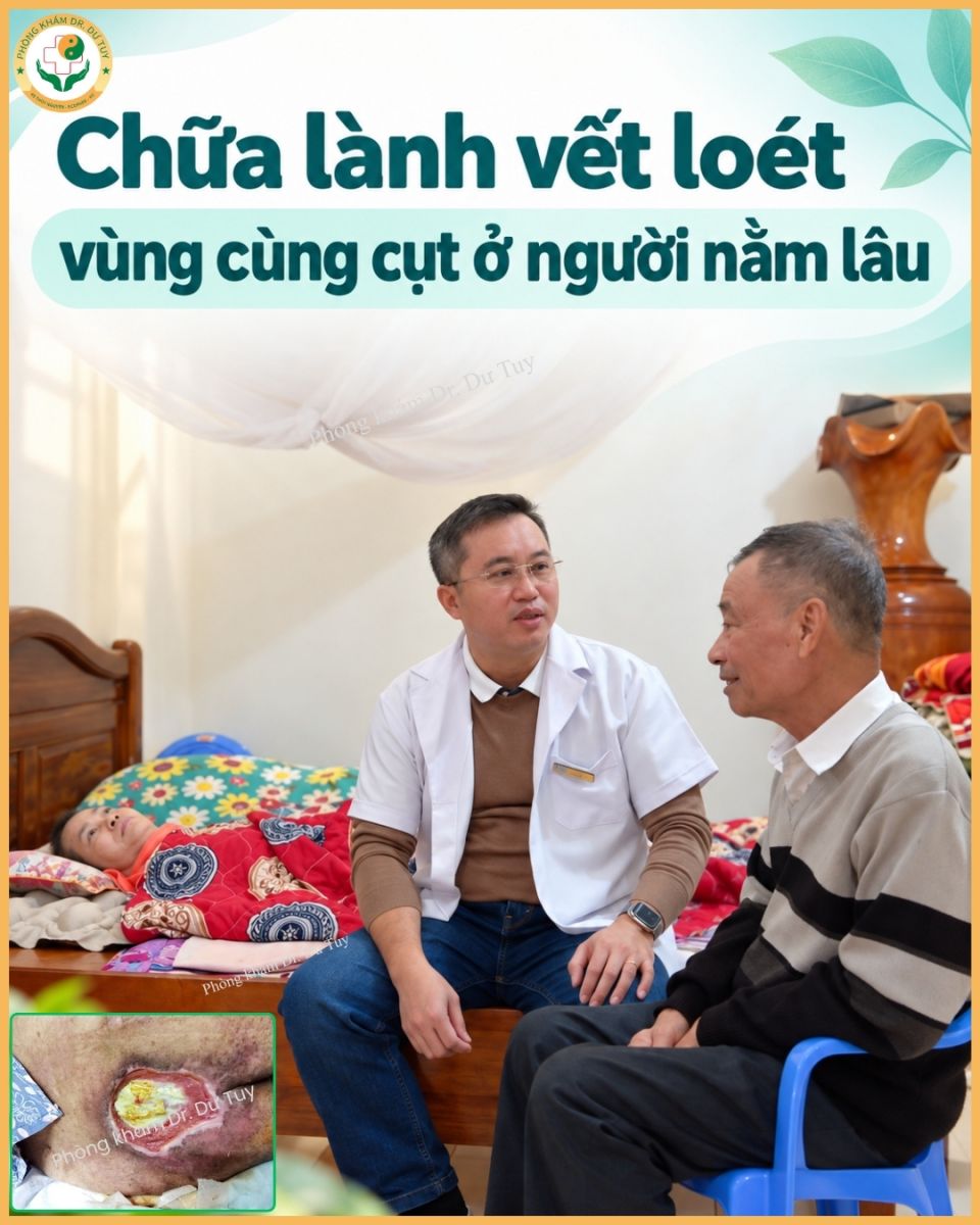 loét da vùng cùng cụt ở người nằm lâu