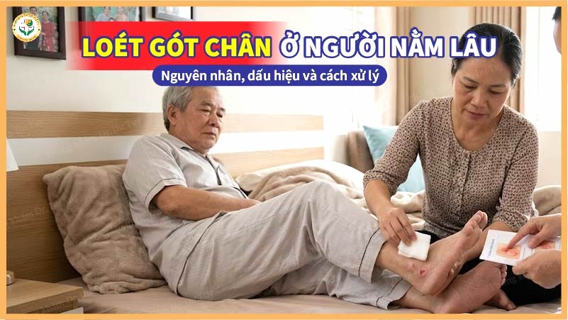 loét gót chân người nằm lâu
