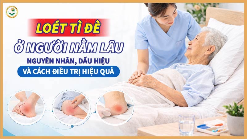 loét tì đè ở người nằm lâu